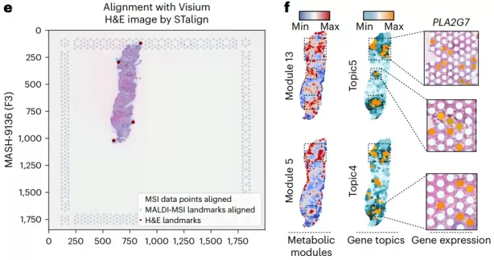 MSI data points and H&E image alignment and Spatial distribution of Metabolic modules